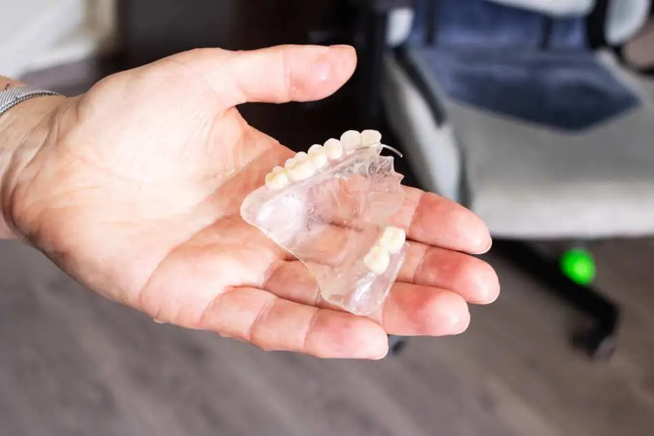 valplast partial dentures