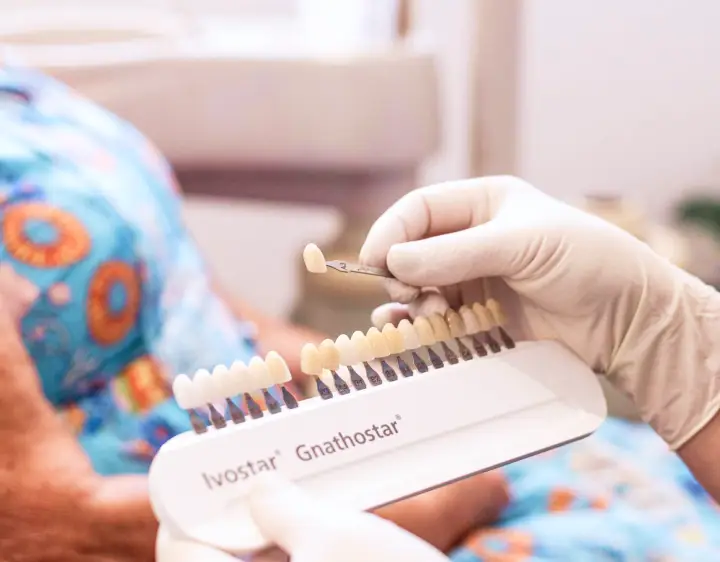 A dentist holds a dental crown against a color shade guide, ensuring the perfect match for patients seeking natural-looking enhancements at the denture clinic.