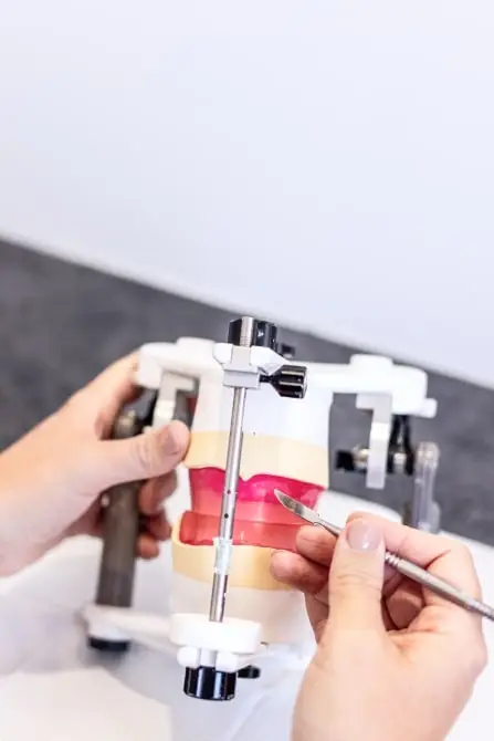 Hands working on a dental model at a leading denture clinic, Gold Coast.
