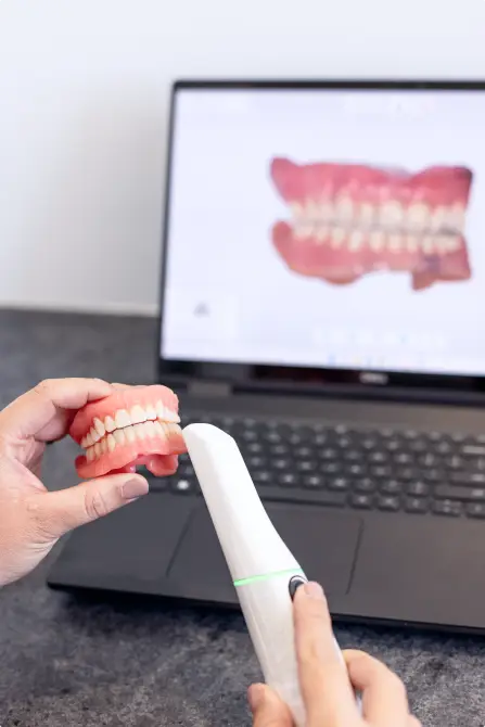 A dental model and scanner sit in front of a laptop, displaying teeth on the screen, showcasing the precision involved in crafting Gold Coast dentures.