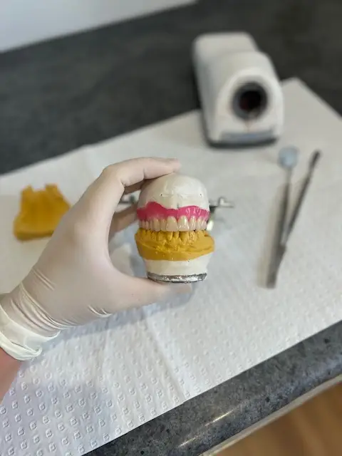 Gloved hand holding a dental mold at a denture clinic with tools in the background.