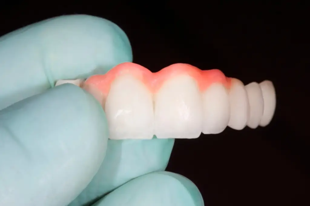 A gloved hand carefully holds a set of valplast dentures, showcasing pink gums and pristine white teeth.