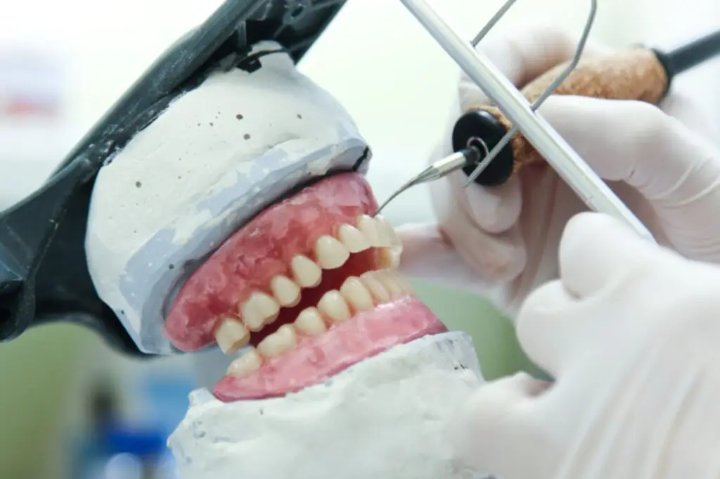 Dental technician fitting immediate dentures in a dental mold.