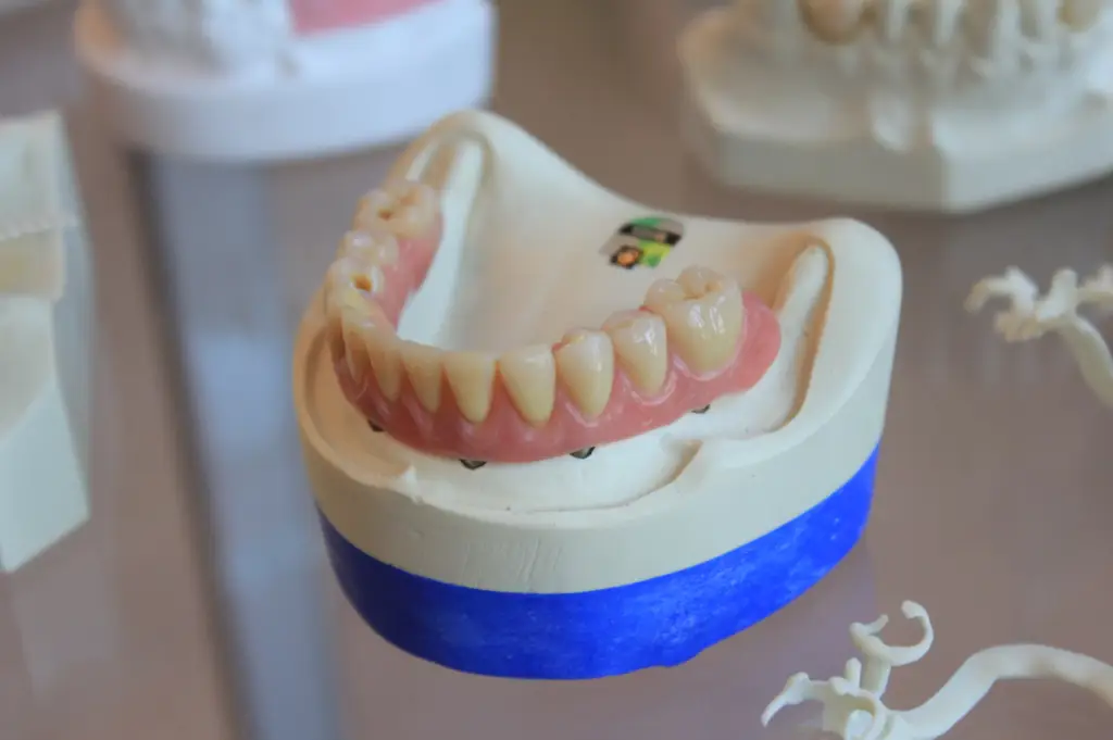 Implant-supported dentures on a reflective surface.