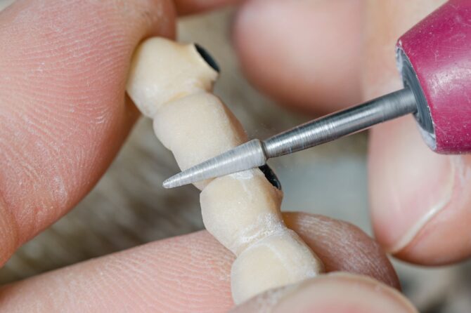 Close-up of a dental tool shaping a bridge, ideal for quick denture repair.