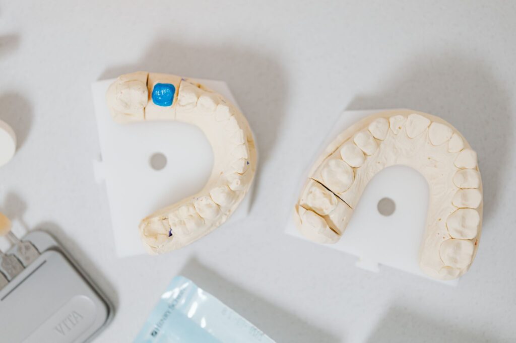 Two dental molds, one marked blue, used for creating implant dentures on a white surface.