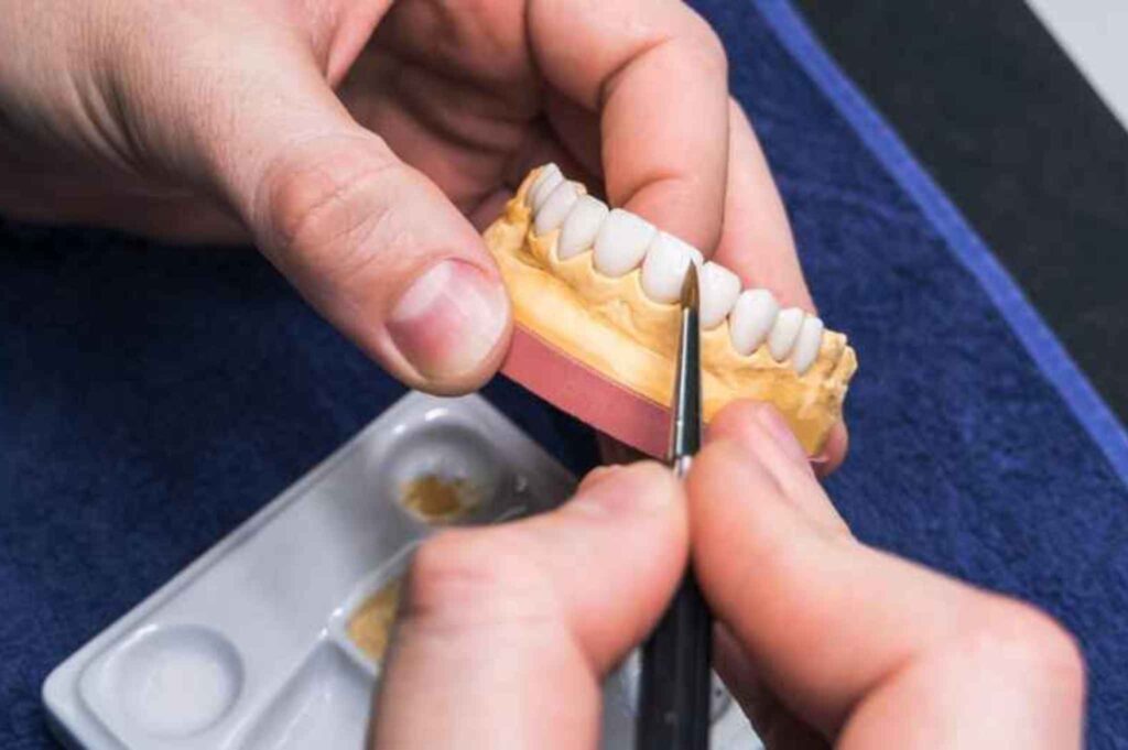 Hands of a dental technician, who makes dentures, shaping artificial teeth on a mold.
