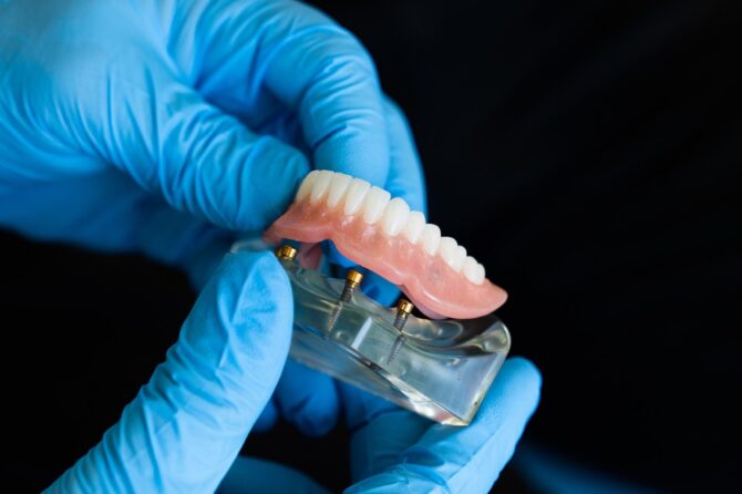 Dental professional holding an implant-supported denture during a routine check-up